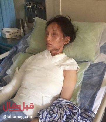 نادل يسكب ماء مغلياً على زبونة اشتكت من الخدمة.. خمنوا كم ربحت من الدعوى!!