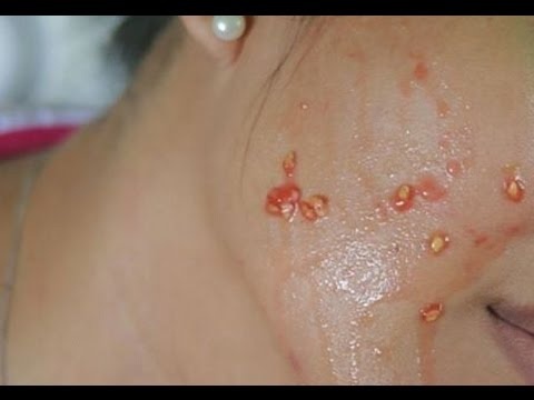 افركي وجهك بالطماطم.. النتيجة مذهلة!