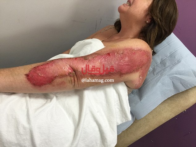 بالصور - احذروا ما قد تفعله بكم هذه اللعبة!