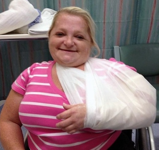 بالصور - سيدة تنكسر أضلاعها مع كل 