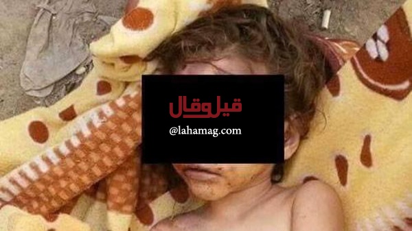 حادثة مروعة - طفلة مصرية تقتل ابنة جارتها بوحشية بتحريض من أمها!!