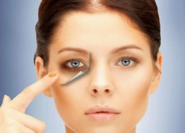 وصفات سهلة وطبيعيّة للتخلّص من الهالات السوداء في المنزل.. جرّبيها