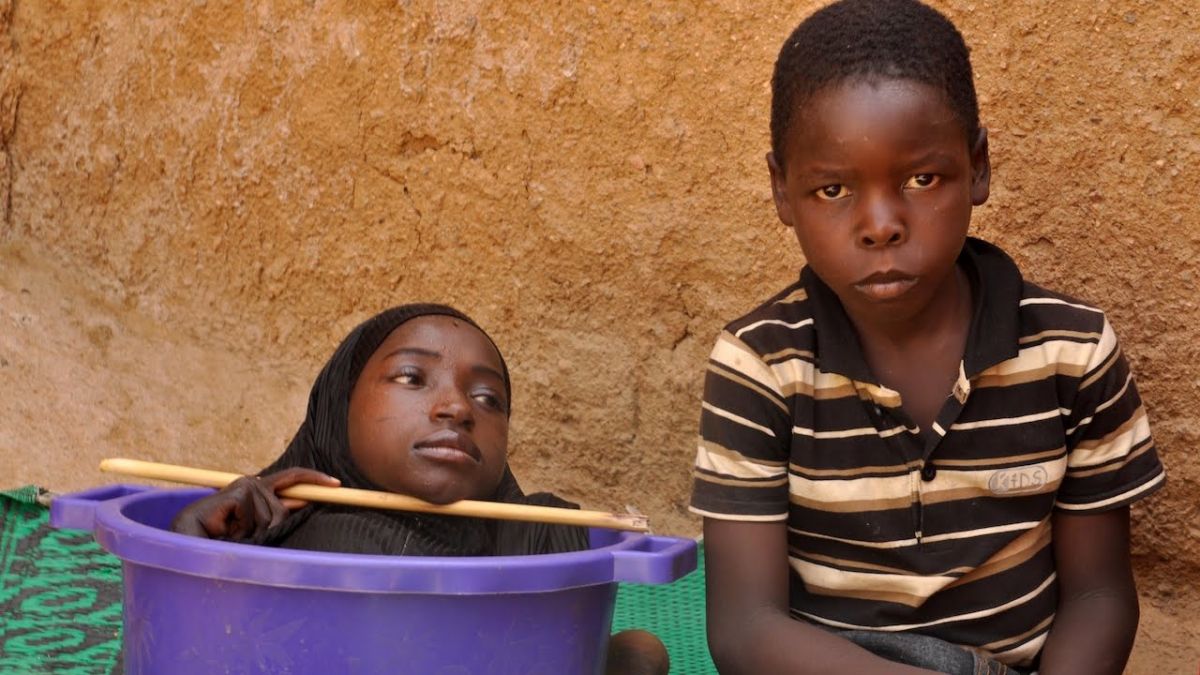 هل تتذكّرون الفتاة التي عاشت 19 عاماً في وعاء بلاستيكي؟ إليكم ما حدث لها أخيراً