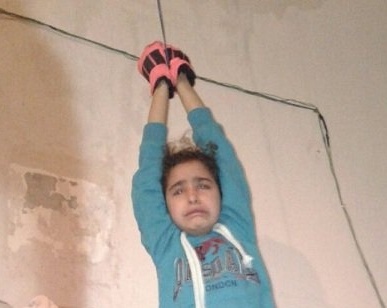 بالصور - في لبنان.. أب يعذب طفلته بوحشية لإجبارها على التسول!