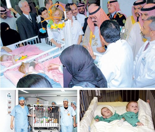 بالفيديو - دكتور سعودي يستقبل توأم سيامي بعد 12 عاماً من عملية فصل.. شاهدوا ماذا حصل!!