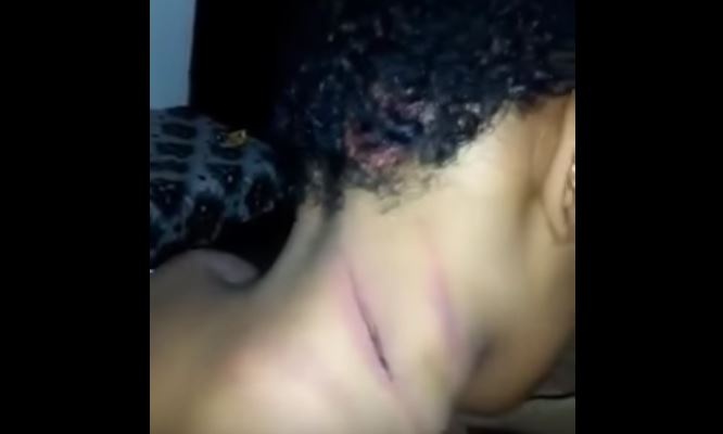 تسريب فيديو مروع لطفل معنف في تبوك.. آثار الضرب على كامل جسده!!