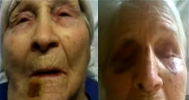 فيديو صادم - عاملة في مأوى تسدّ فم امرأة عجوز بملابس وسخة... وما أظهرته الكاميرا أكثر وحشية