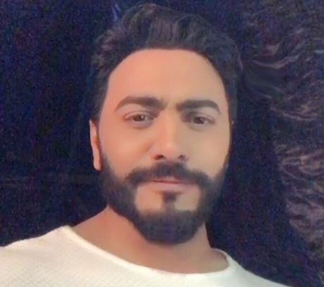 تامر حسني بفيديو مباشر من أحد المقاهي.. شاهدوا ماذا حصل!؟