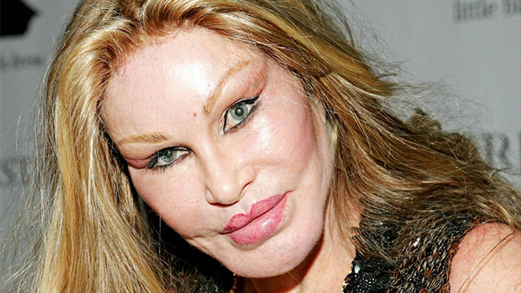 بالصور - نجمات أنفقن الملايين على عمليات التجميل.. أرقام خيالية!!