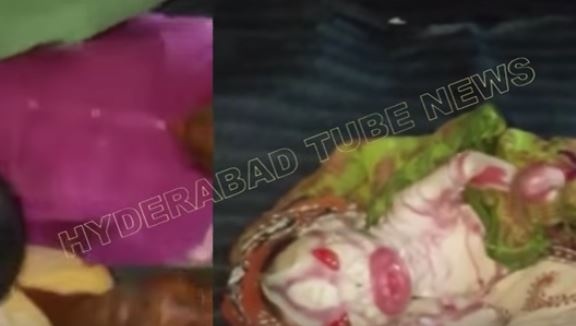 بالفيديو - ولادة طفل يشبه المخلوقات الفضائية.. وردّ فعل امه لا يصدق!