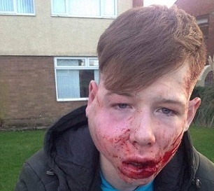 صور (+18) - هكذا اصبح الصبي بعد الاعتداء عليه!