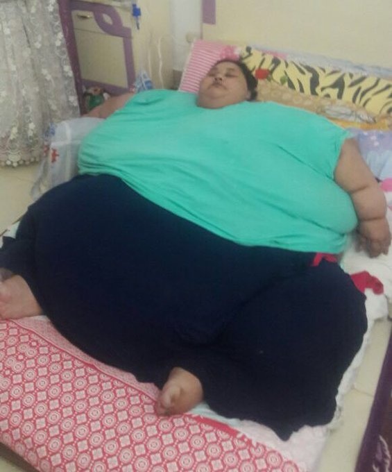 هذا ما حصل لاسمن امرأة مصرية بعد اسبوع من دخولها المستشفى.. لا يصدق!