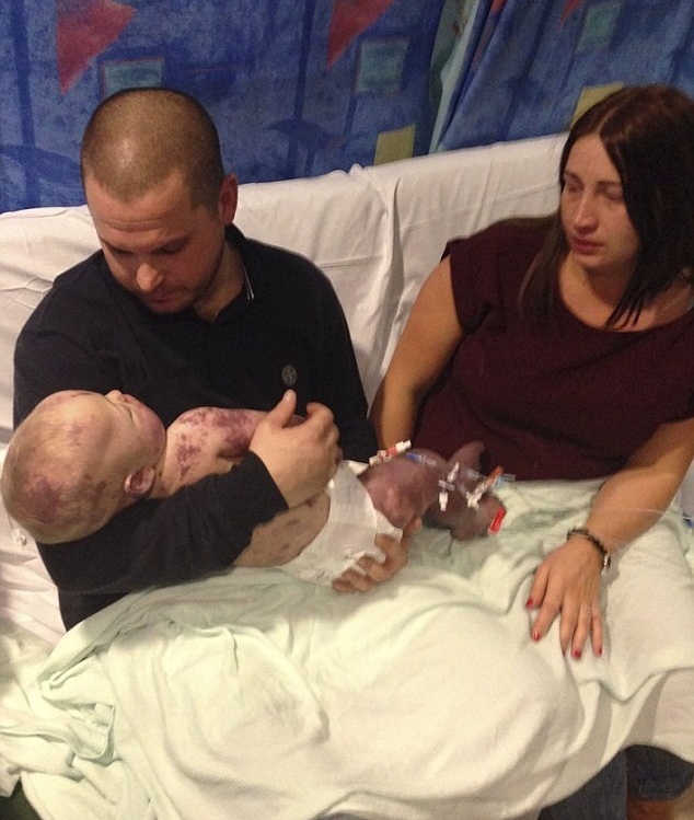 صور مؤلمة - والدان ينشران لحظة وفاة رضيعهما لهذا السبب!!