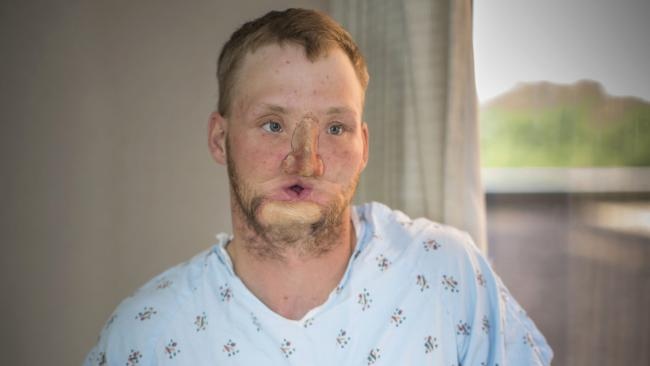 بالصور - كيف أصبح بعد عمليات التجميل... ستصدمون حقاً!