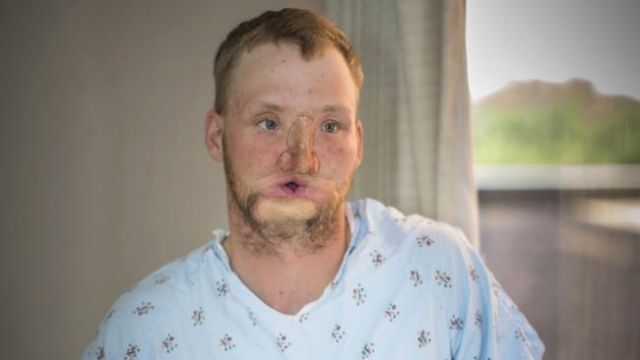 بالصور - كيف أصبح بعد عمليات التجميل... ستصدمون حقاً!