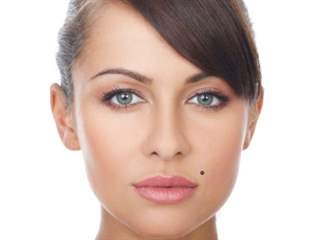 هكذا تعرفين إذا كانت الشامة في جسمك حميدة أم خبيثة!