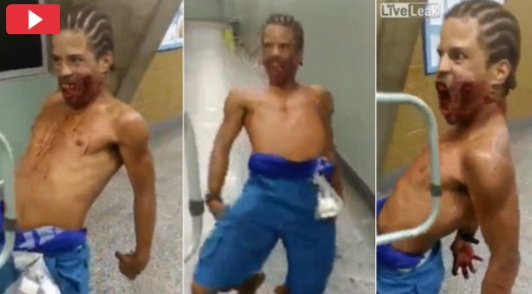 بالفيديو - رجل مصاب بطلق ناري في وجهه.. يرقص في المستشفى!