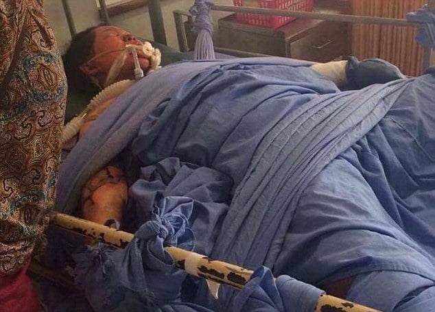 صور (+18) - أحرق زوجته حية بسبب 