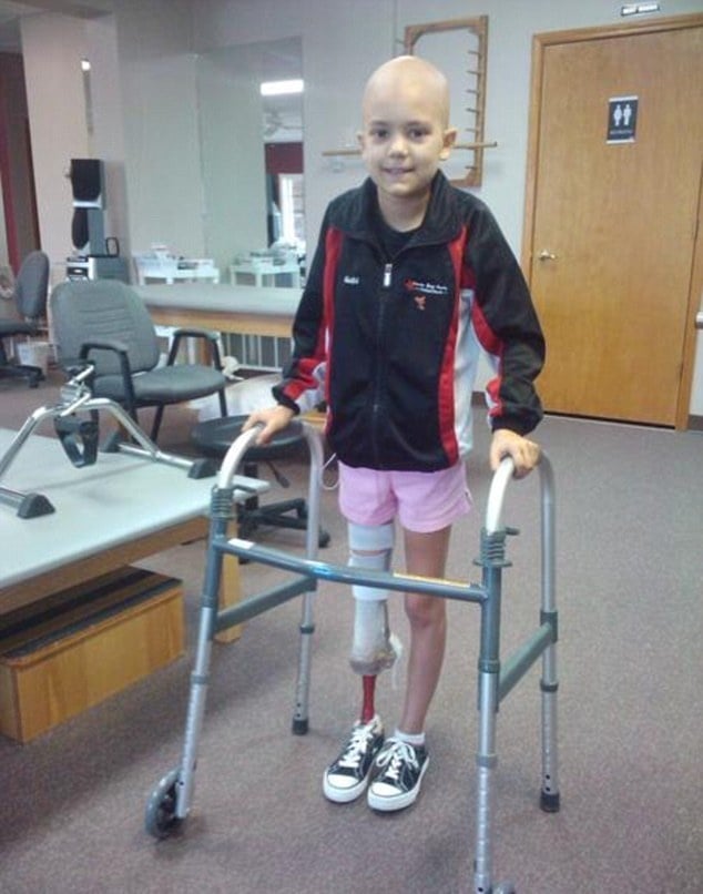 بالفيديو - مبتورة القدم وتعاني من سرطان نادر... شاهدوا رقصها المدهش
