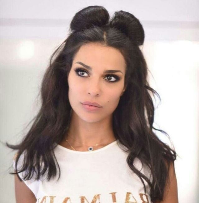 حصري لها- من ضرب نادين نجيم بالهاتف الخلوي على عينها؟؟