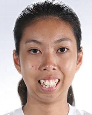 بالصورة - عملية تجميل واحدة في وجهها غيرت شكلها بالكامل.. لن تصدقوا كيف أصبحت!!