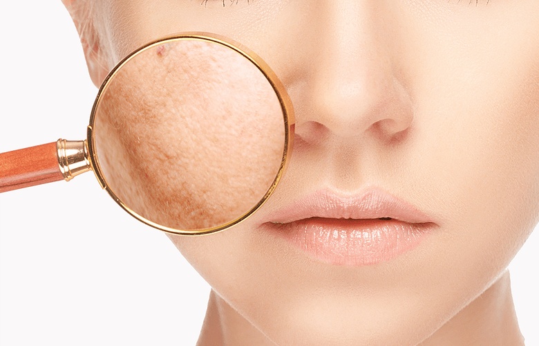 نصائح سهلة لتقليص مسامات الوجه