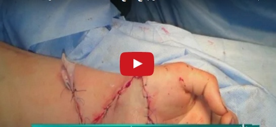 بالفيديو - حادثة تهز مصر: قطع يد شقيقته بسبب زوجته.. إليكم التفاصيل