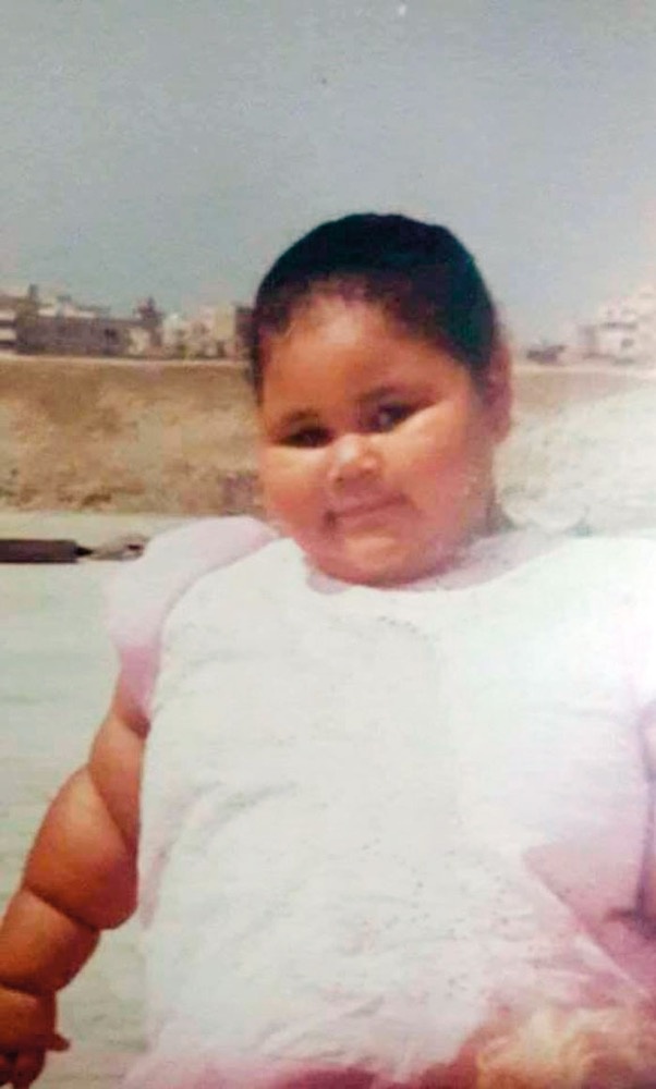 وهي طفلة... تبدو عليها السُمنة