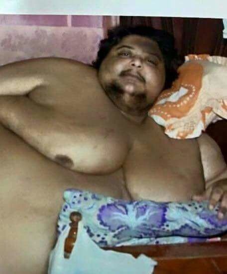 بعد فشل علاج أسمن امرأة في الهند - أسمن رجل في مصر يخضع لجراحة ويخسر وزناً.. لن تصدقوا كم كان يزن!!