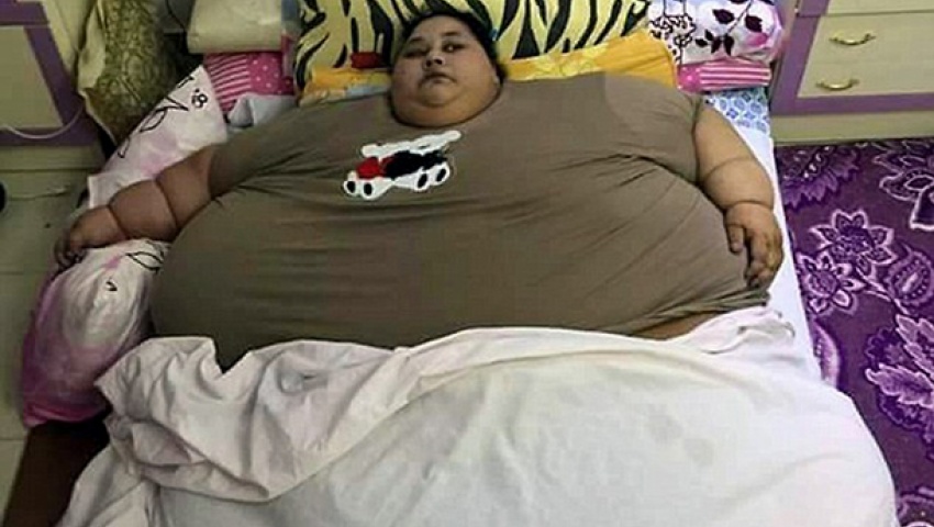 بالفيديو - أسمن امرأة في العالم تخضع لأول جلسة علاج طبيعي.. وشقيقتها تهاجم الطاقم الطبي الهندي!!