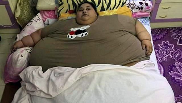 بالفيديو - أسمن امرأة في العالم تخضع لأول جلسة علاج طبيعي.. وشقيقتها تهاجم الطاقم الطبي الهندي!!