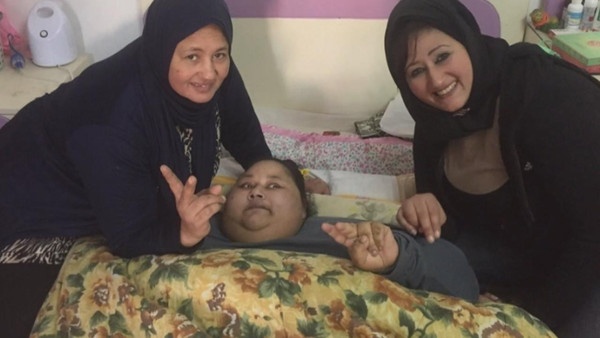 الحكومة المصرية تكشف تفاصيل قصة ايمان ذات النصف طن من الهند... إلى أبو ظبي