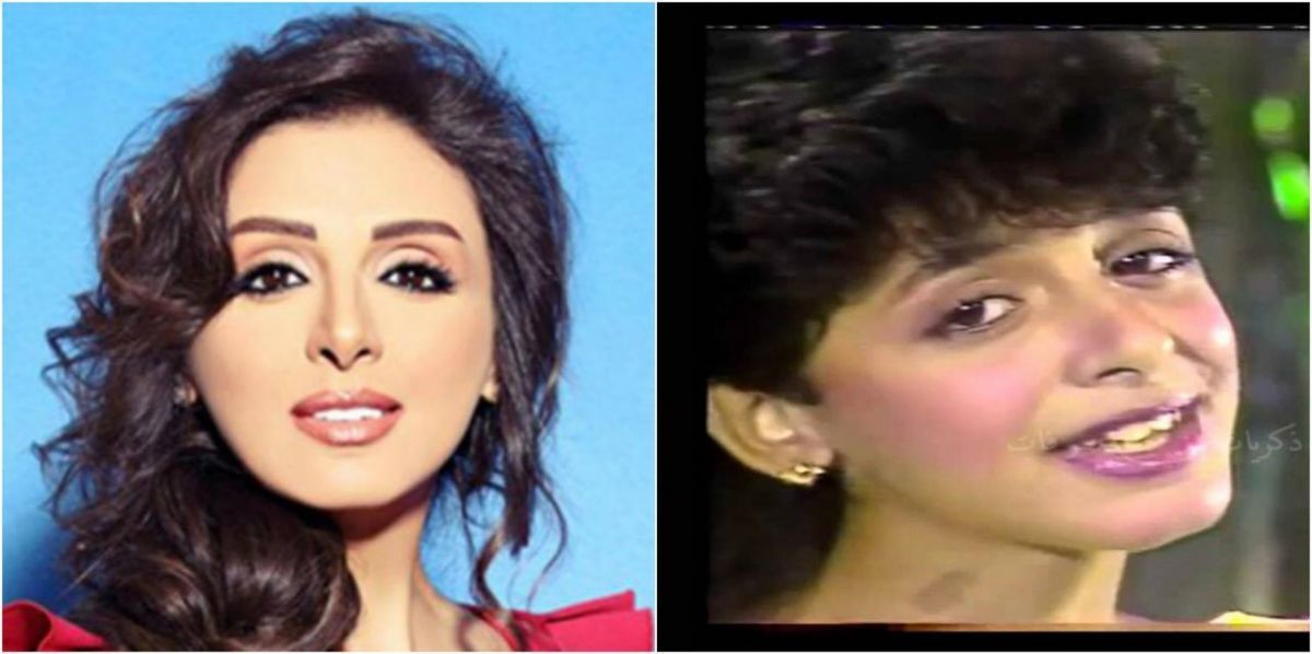 كيف غيّر المال شكل هؤلاء الفنانين! لن تصدقوا