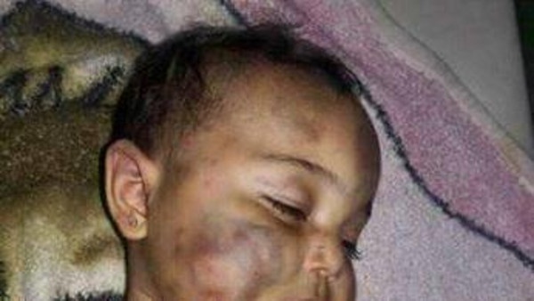 صور مروعة.. أب سوري يقتل طفلته 