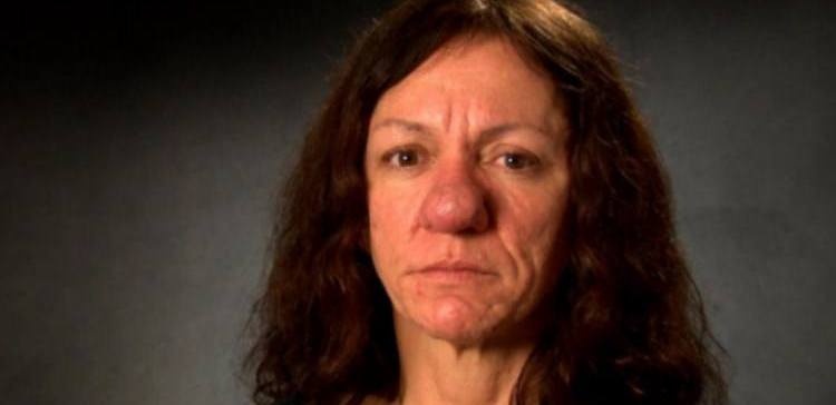 بالفيديو - عانت من حساسية جلدية قوية أدت الى تورم أنفها.. شاهدوا كيف أصبح شكلها المفاجئ بعد العلاج!!