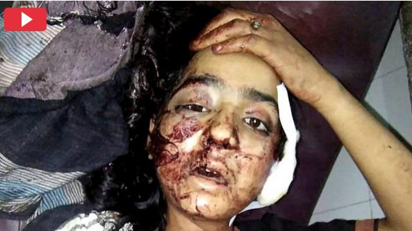 بالفيديو - إطلاق النار على شابة في 