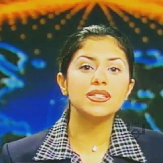 بالصور - لن تصدقوا من هذه النجمة العربية قبل عمليات التجميل!