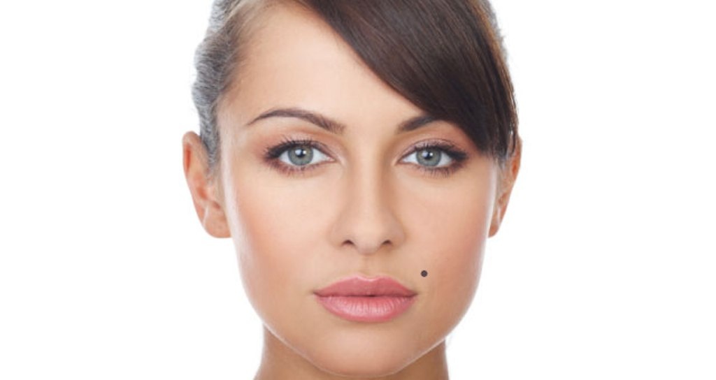 هكذا يمكنكم التمييز بسهولة بين الشامة السرطانية والحميدة... لا تنسوا هذه العلامات