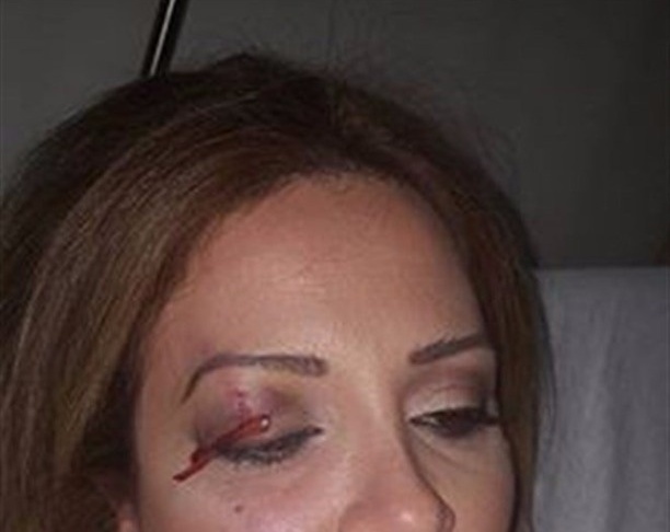 بالصور - نجاة إعلامية لبنانية من الموت... هذا ما حصل لها!