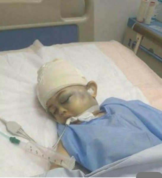 «طفل بامبرز» جديد يهزّ مصر – اختطف واغتصب ورُمي من السطح... والفاعلان بالصورة