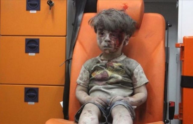 بالصور- هل تتذكّرون الطفل السوري عمران الذي أبكى الملايين؟ شاهدوا كيف أصبح