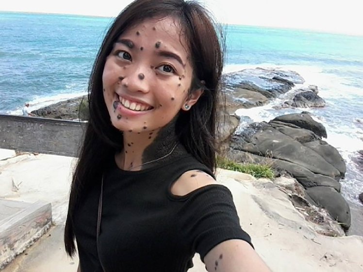 بالصور - لن تصدقوا! هذه الشابة مرشحة لملكة جمال الكون... اليك التفاصيل الغريبة!