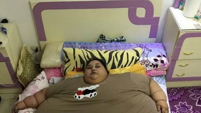 بالصور - شاهدوا كيف أصبحت المصرية صاحبة النصف طن بعد العلاج!