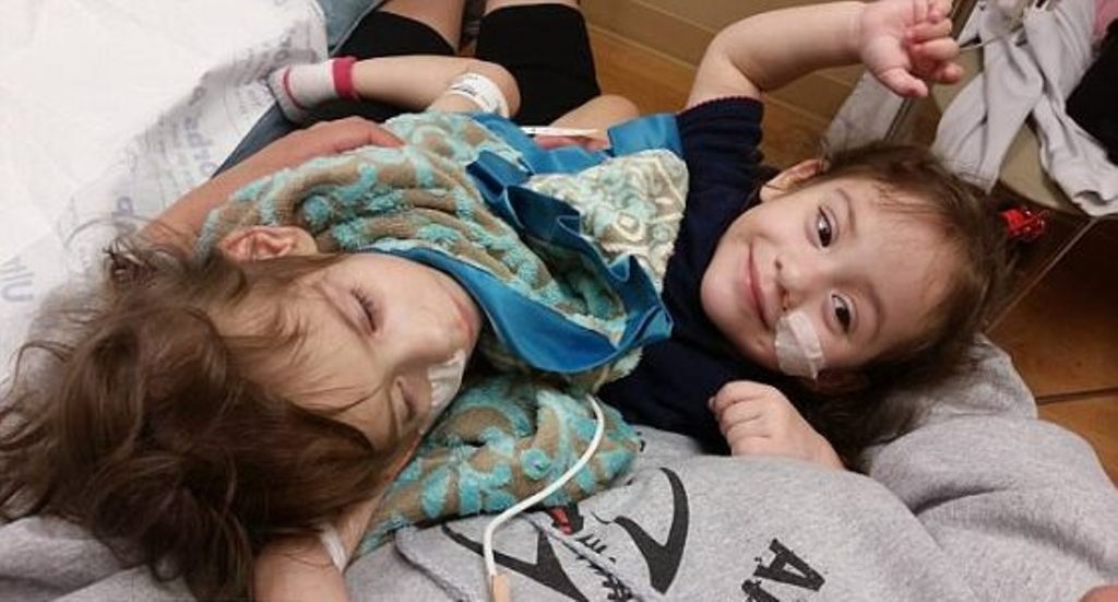 بالصور- ولدتا بجسمين متلاصقين وخضعتا لعملية خطرة... شاهدوا كيف أصبحت هاتان الطفلتان بعد فصلهما