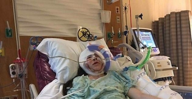 بالصور - إيفانكا ولدت بوجه غير مكتمل.. شاهدوا كيف أصبحت بعد عمليات التجميل!؟