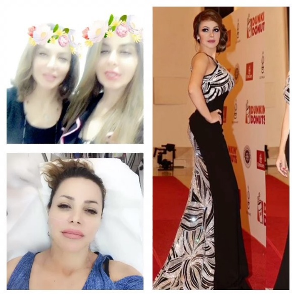 بالصور - سوزان نجم الدين تخضع لعمليات تجميل و
