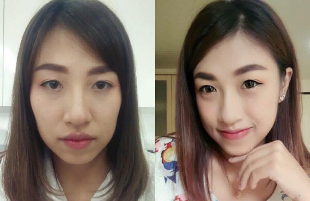 بالصور - طريقة غريبة لتصغير الشفاه الضخمة... هكذا تصبحين أكثر أنوثة