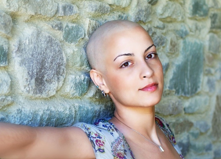 قاس ومؤلم- مريضة سرطان سعودية تتعرض للطرد والإهانة في الملاهي بسبب تساقط شعرها... 