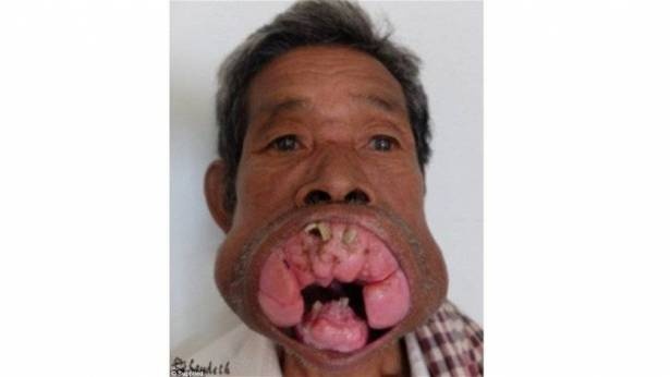 بالصور - لن تصدقوا كيف اصبح بعد عمليات التجميل!