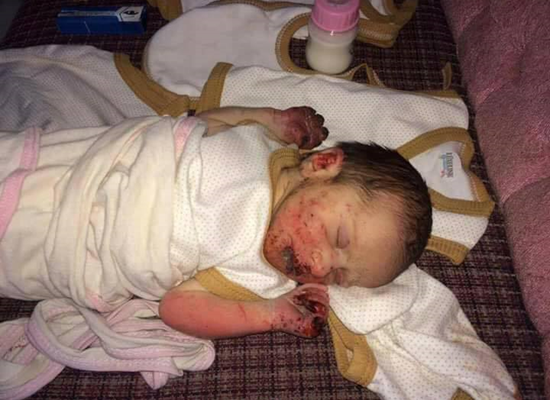 تفاصيل جديدة حول مصير الطفلة المجهولة التي أكلت القوارض جسدها.. وهذا اسمها الجديد!